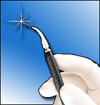 laser gum disease treatment smile of skokie