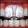Night Guard, general and cosmetic dental services