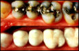 Broken Teeth, general and cosmetic dental services