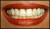 teeth whitening for life, general and cosmetic dental services